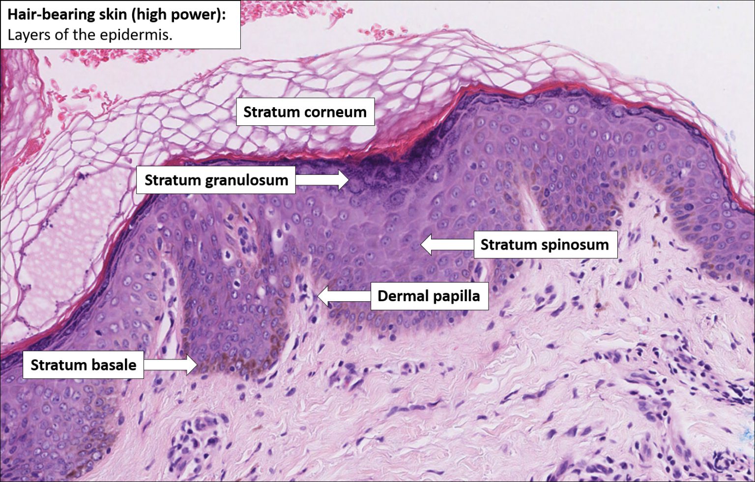 Skin – Normal Histology – NUS Pathweb :: NUS Pathweb