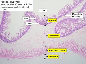 Small bowel – Normal Histology – NUS Pathweb :: NUS Pathweb