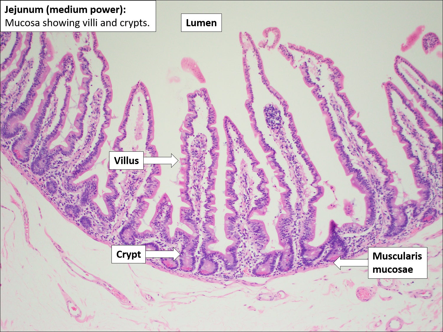 Small Bowel Normal Histology NUS Pathweb NUS Pathweb