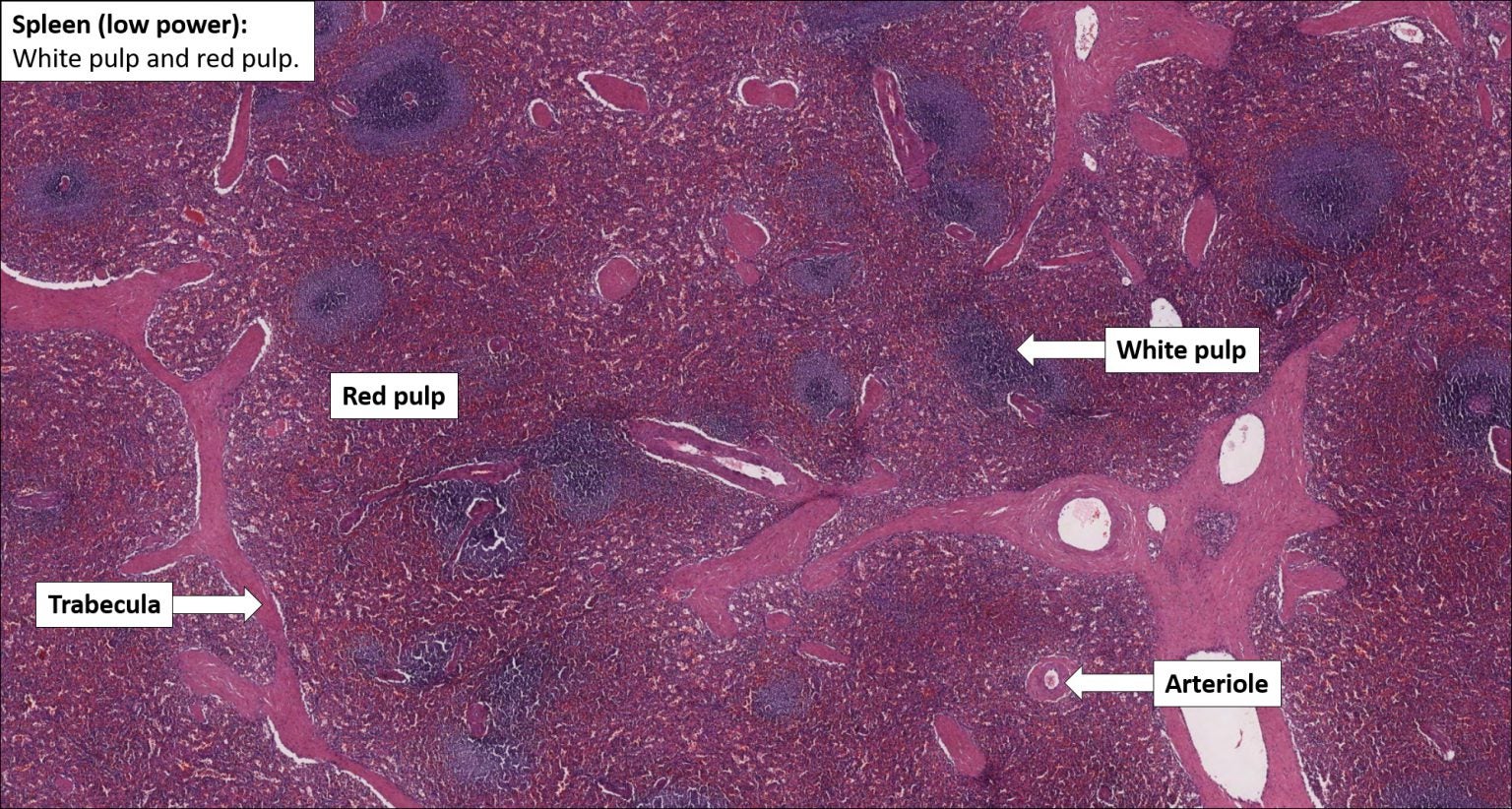 Spleen Normal Histology NUS Pathweb NUS Pathweb