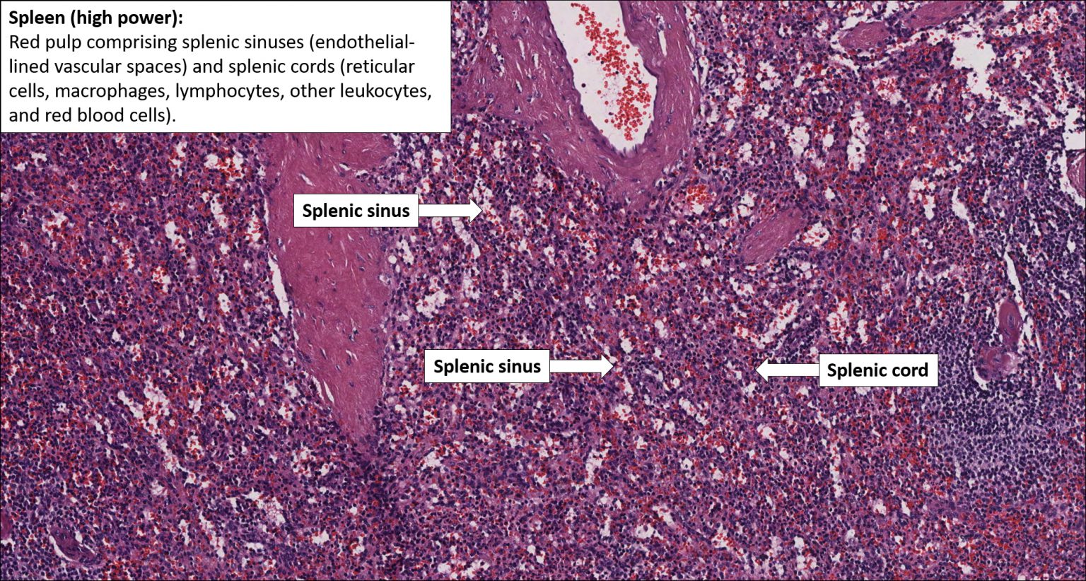 Spleen – Normal Histology – NUS Pathweb :: NUS Pathweb