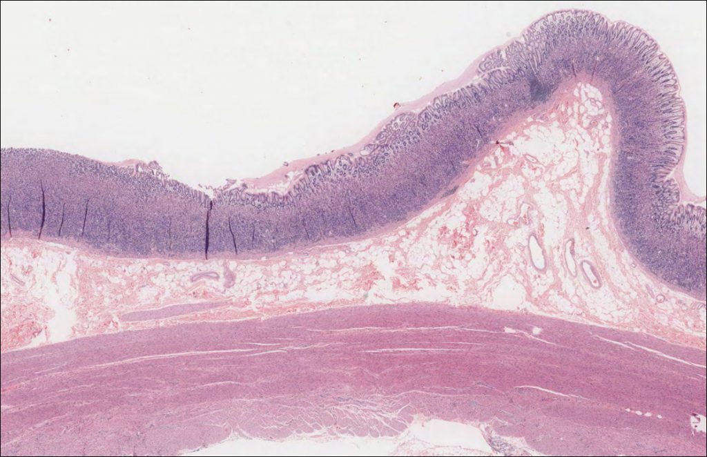 Stomach Normal Histology NUS Pathweb NUS Pathweb