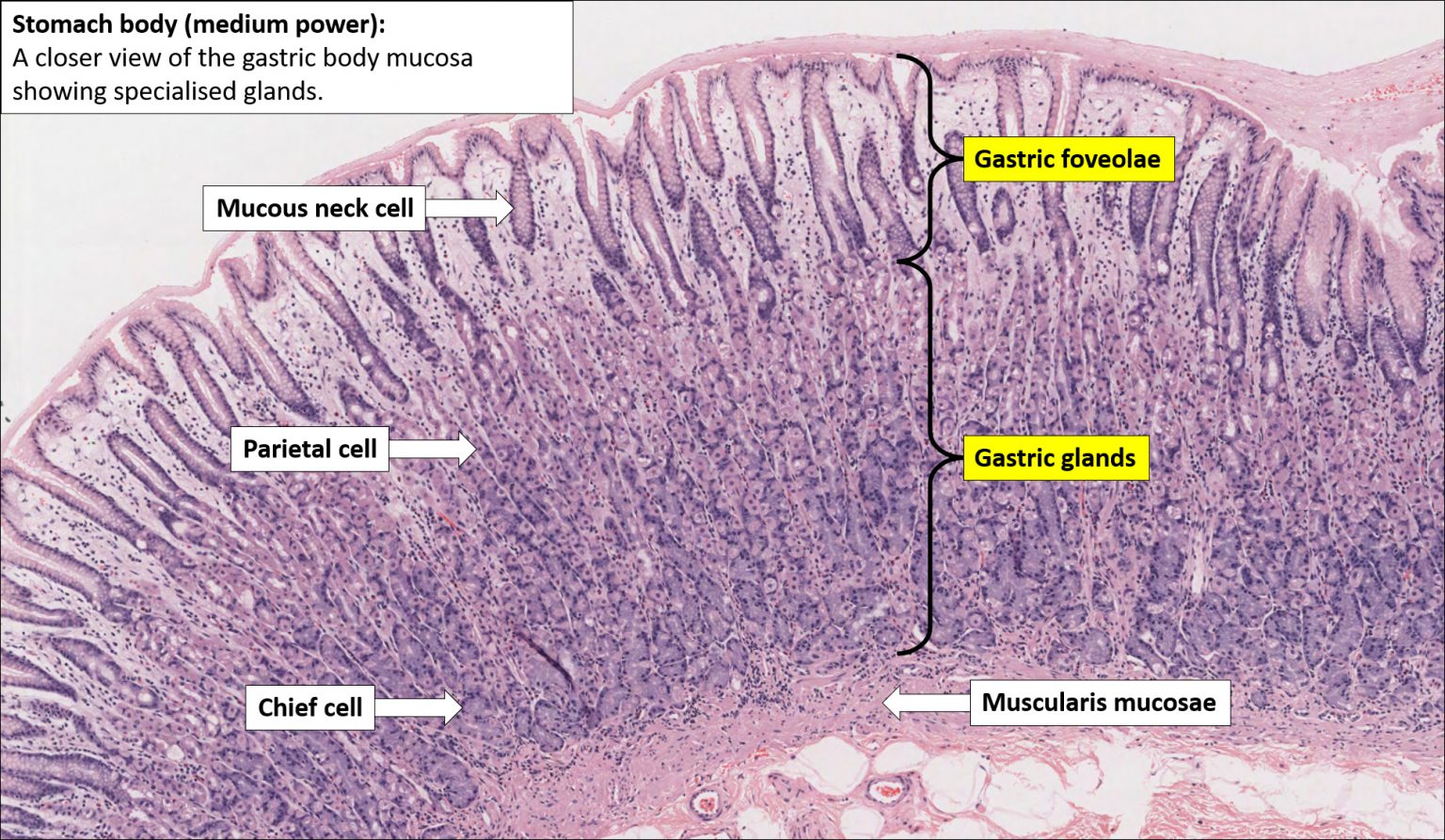 Stomach Normal Histology Nus Pathweb Nus Pathweb 