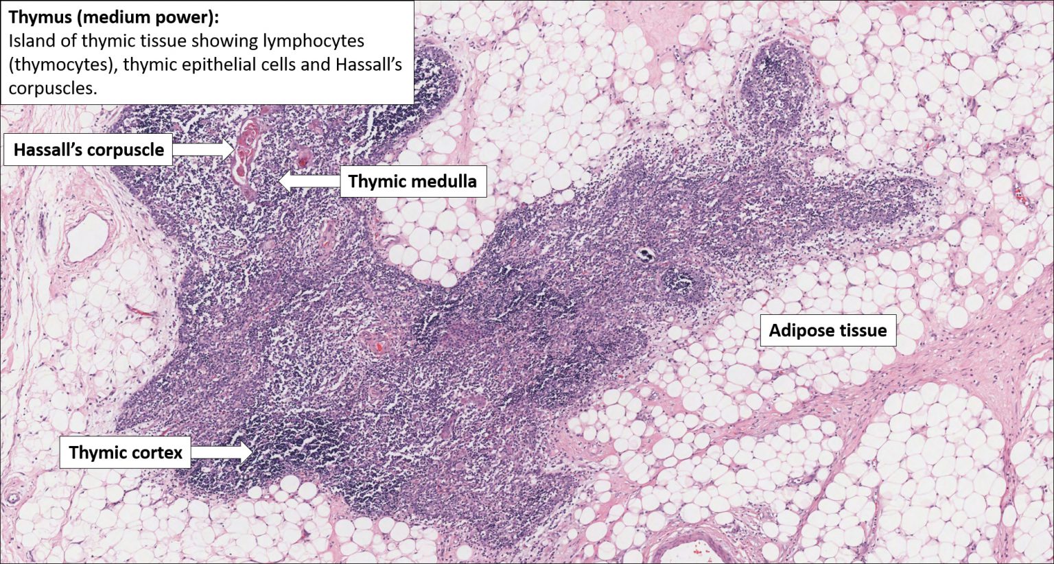 Thymus Normal Histology Nus Pathweb Nus Pathweb