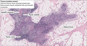 Thymus – Normal Histology – Nus Pathweb :: Nus Pathweb