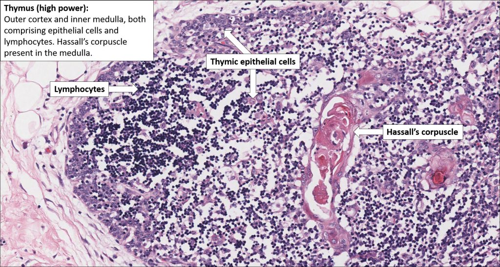 Thymus – Normal Histology – NUS Pathweb :: NUS Pathweb