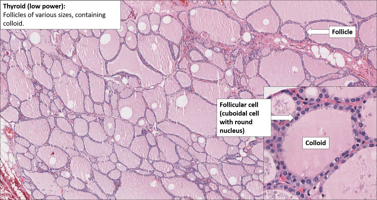 Thyroid – Normal Histology – NUS Pathweb :: NUS Pathweb