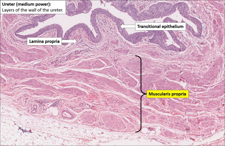 Ureter – Normal Histology – NUS Pathweb :: NUS Pathweb