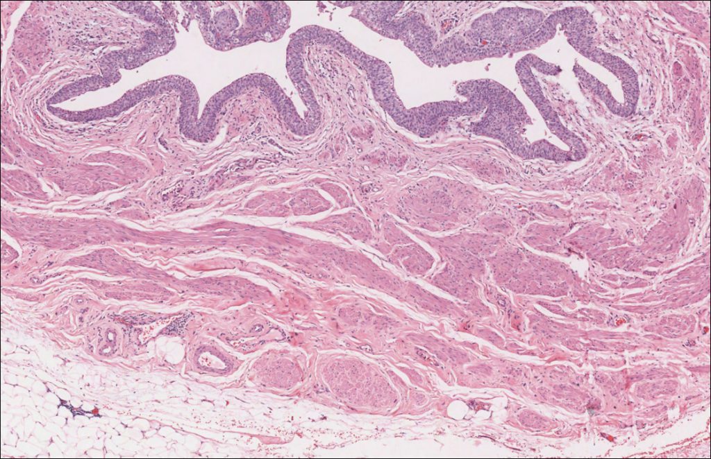 Ureter – Normal Histology – NUS Pathweb :: NUS Pathweb