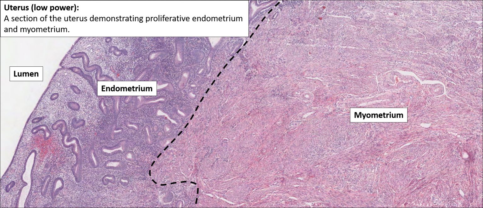 Uterus Normal Histology Nus Pathweb Nus Pathweb