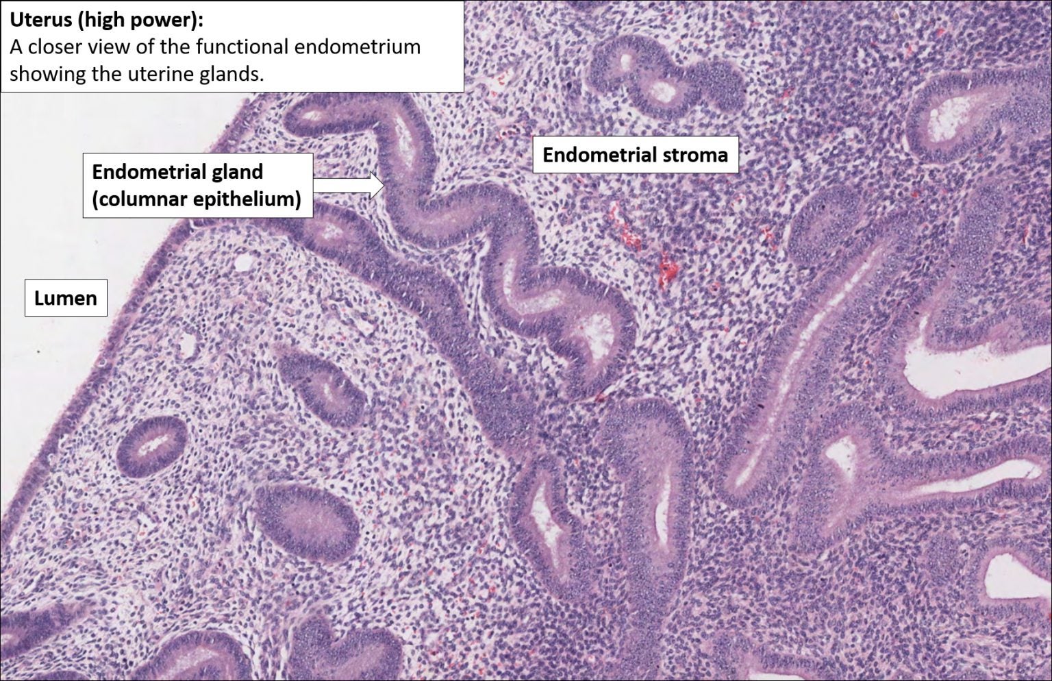 Uterus – Normal Histology – NUS Pathweb :: NUS Pathweb