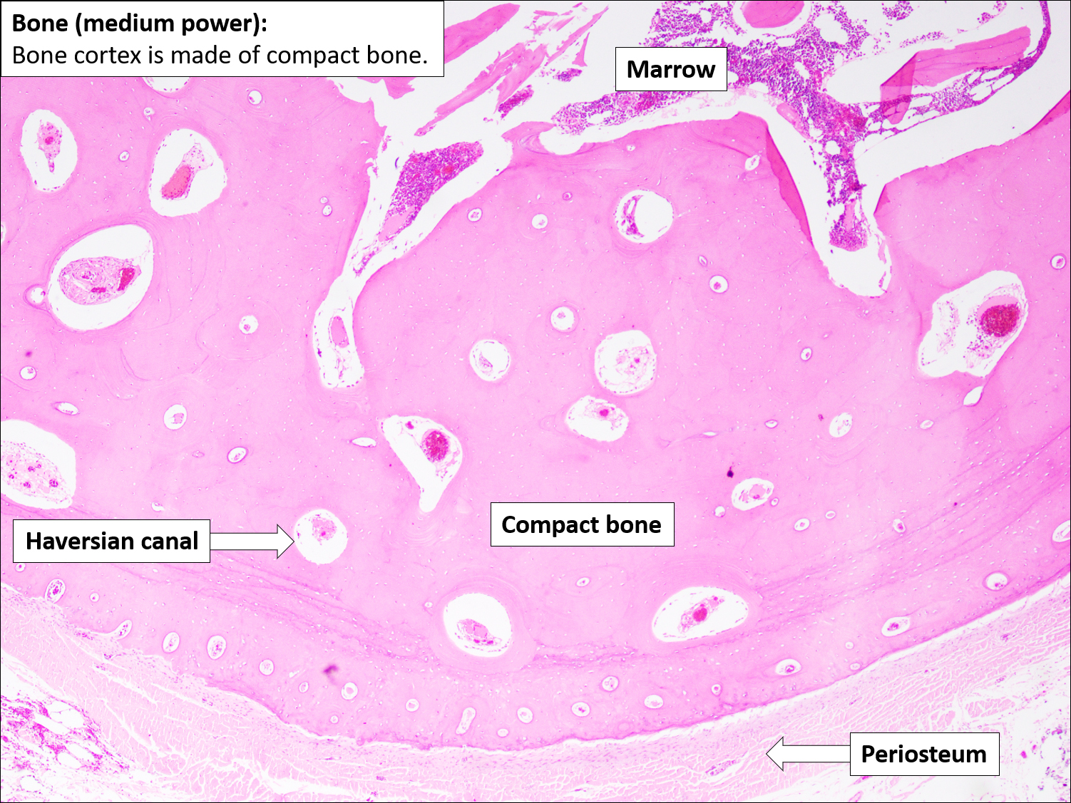 Bone – Normal Histology – NUS Pathweb
