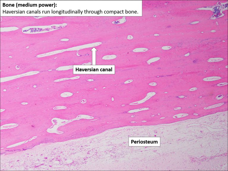 Bone – Normal Histology – NUS Pathweb :: NUS Pathweb