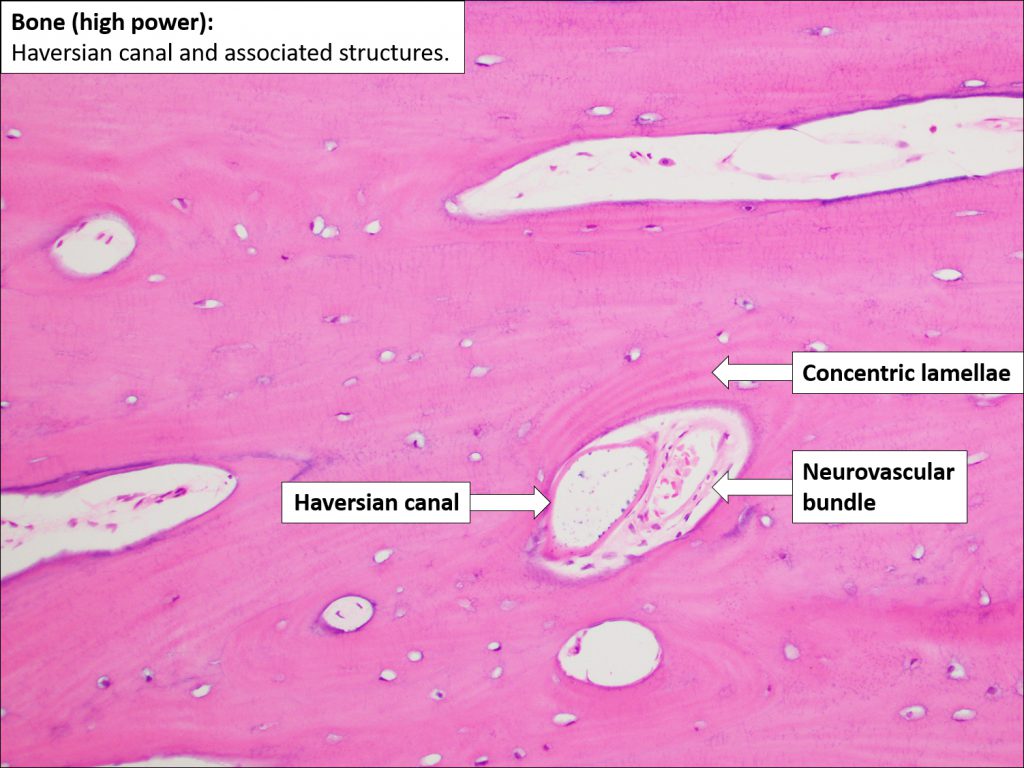 Bone – Normal Histology – NUS Pathweb :: NUS Pathweb