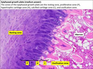 Bone – Normal Histology – NUS Pathweb :: NUS Pathweb