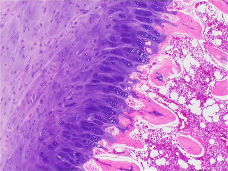 Bone – Normal Histology – NUS Pathweb :: NUS Pathweb