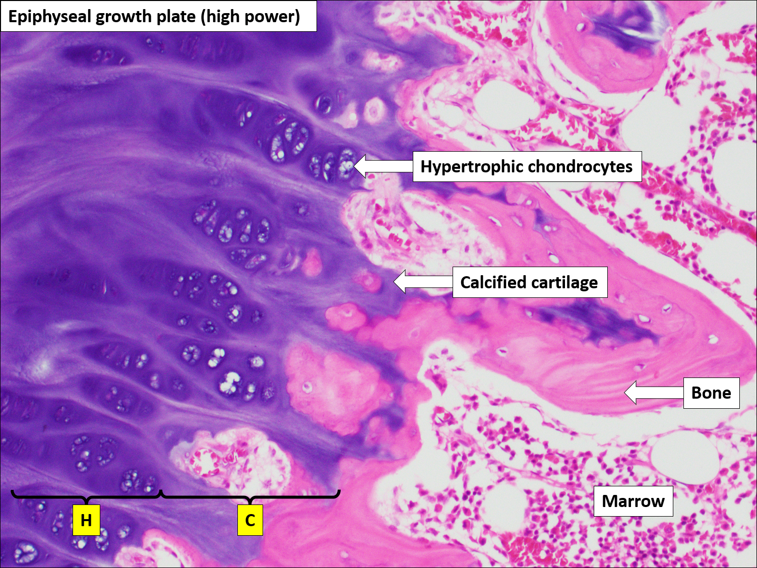Bone Normal Histology Nus Pathweb