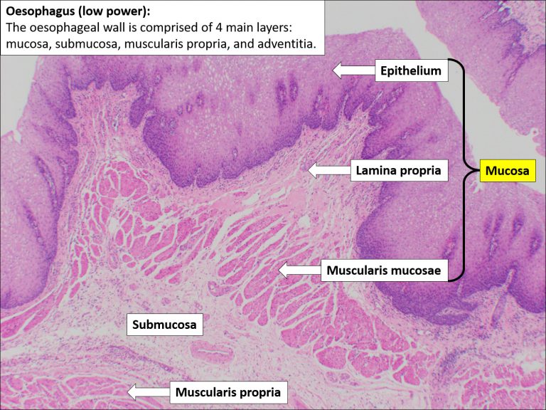 Oesophagus – Normal Histology – NUS Pathweb :: NUS Pathweb