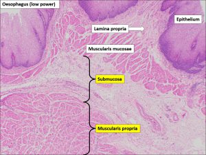 Oesophagus – Normal Histology – NUS Pathweb :: NUS Pathweb