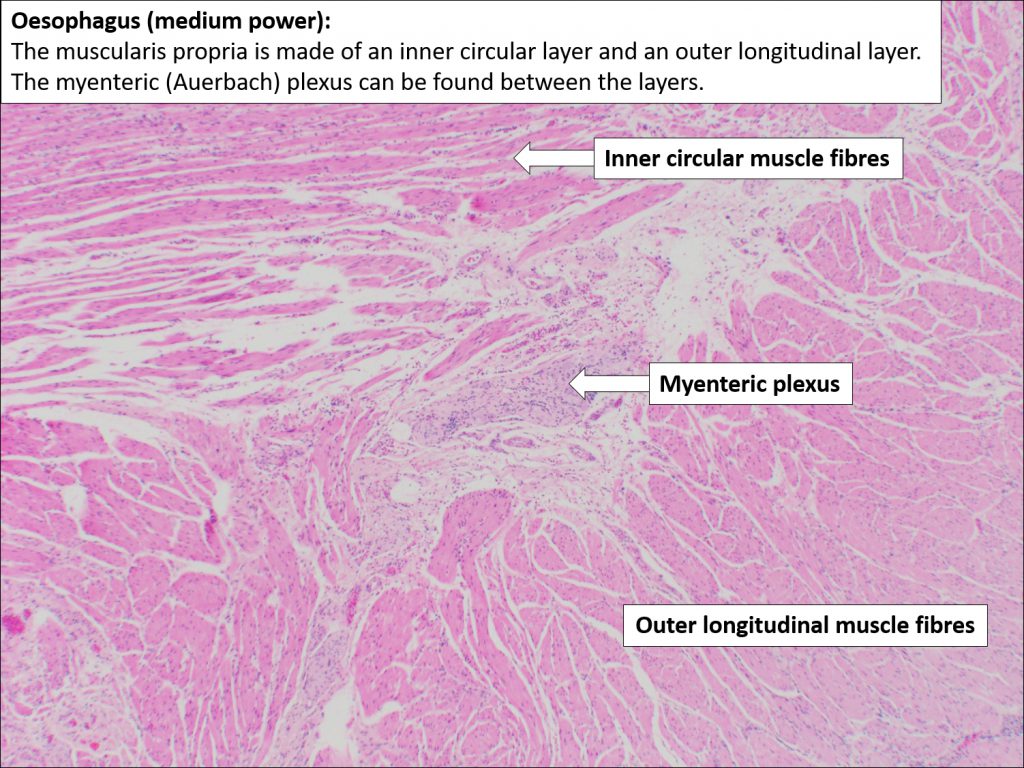 Oesophagus – Normal Histology – NUS Pathweb :: NUS Pathweb