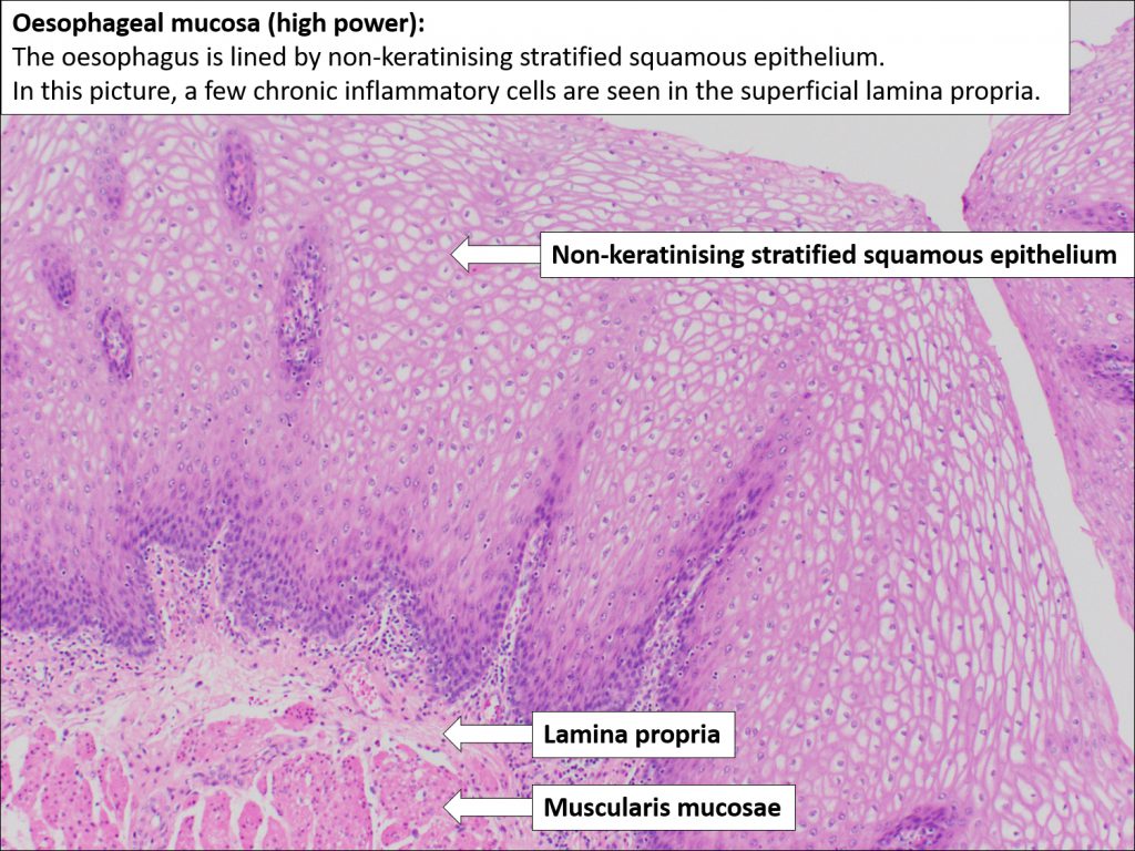 Oesophagus Normal Histology Nus Pathweb Nus Pathweb