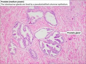 Prostate – Normal Histology – NUS Pathweb :: NUS Pathweb