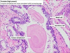 Prostate – Normal Histology – NUS Pathweb :: NUS Pathweb