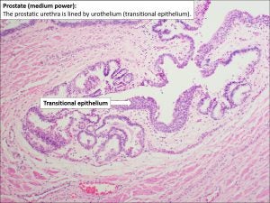 Prostate – Normal Histology – NUS Pathweb :: NUS Pathweb