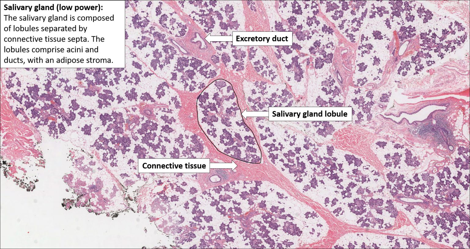 Salivary Gland Normal Histology Nus Pathweb Nus Pathweb