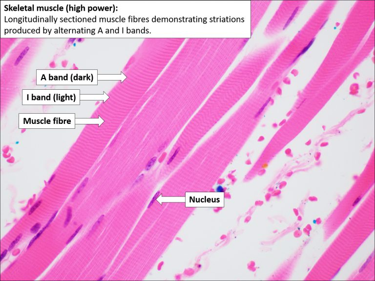 Skeletal Muscle – Normal Histology – NUS Pathweb :: NUS Pathweb