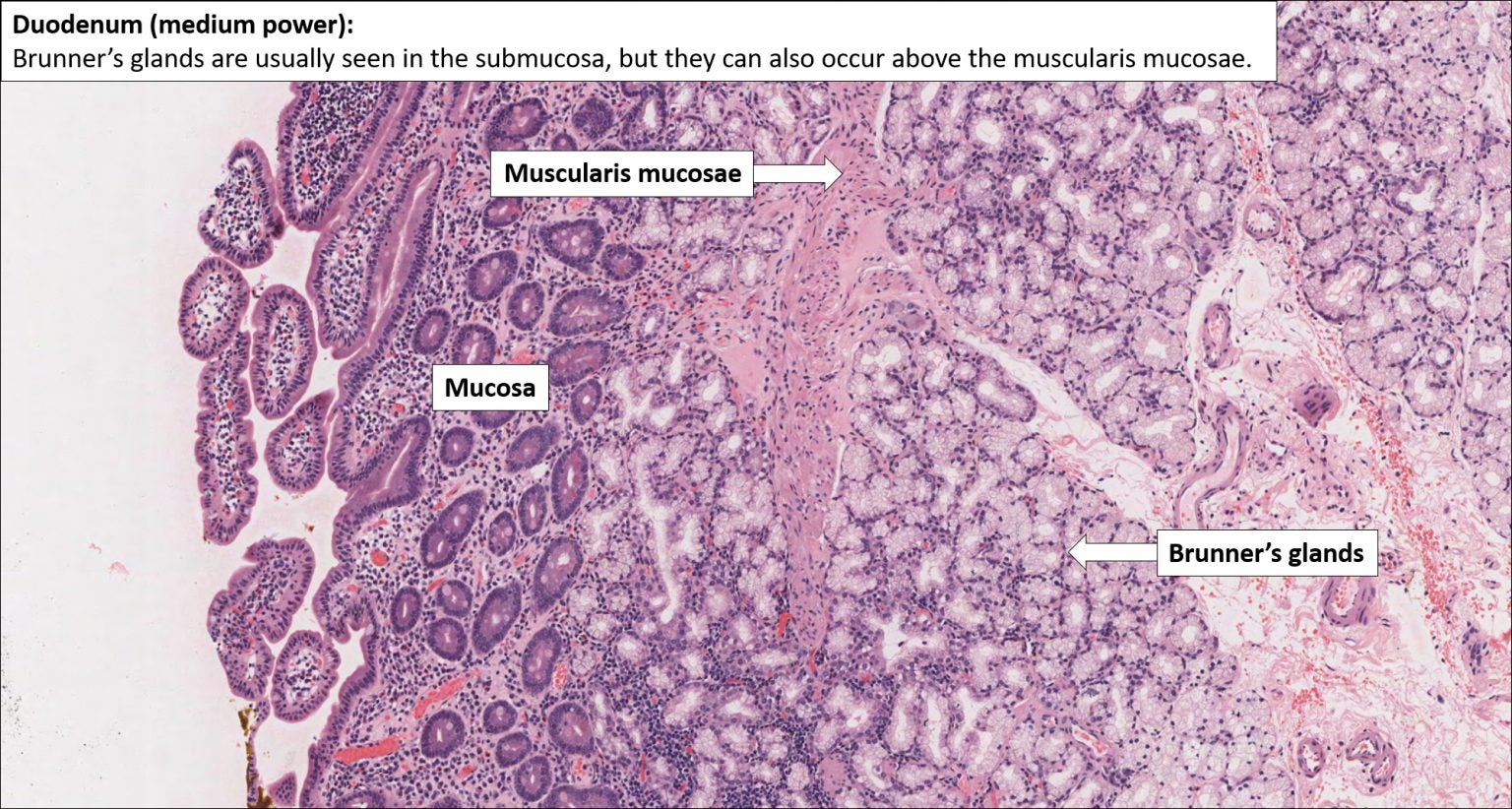 Small bowel Normal Histology NUS Pathweb NUS Pathweb