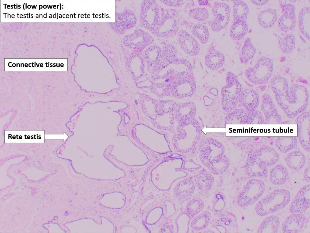 Testis And Epididymis Normal Histology Nus Pathweb Nus Pathweb 4609