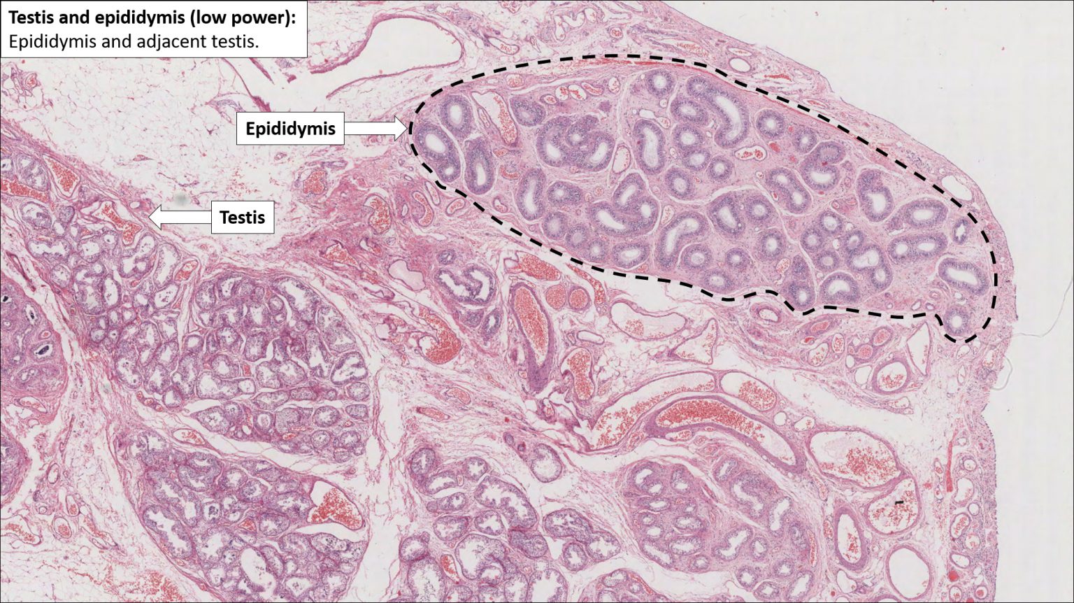 Testis Histology Labeled