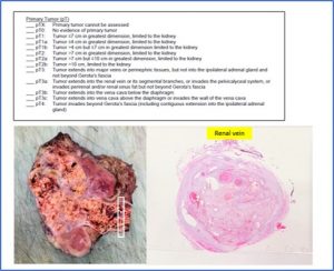 Pathology in Action: Real Life Cases – NUS Pathweb :: NUS Pathweb