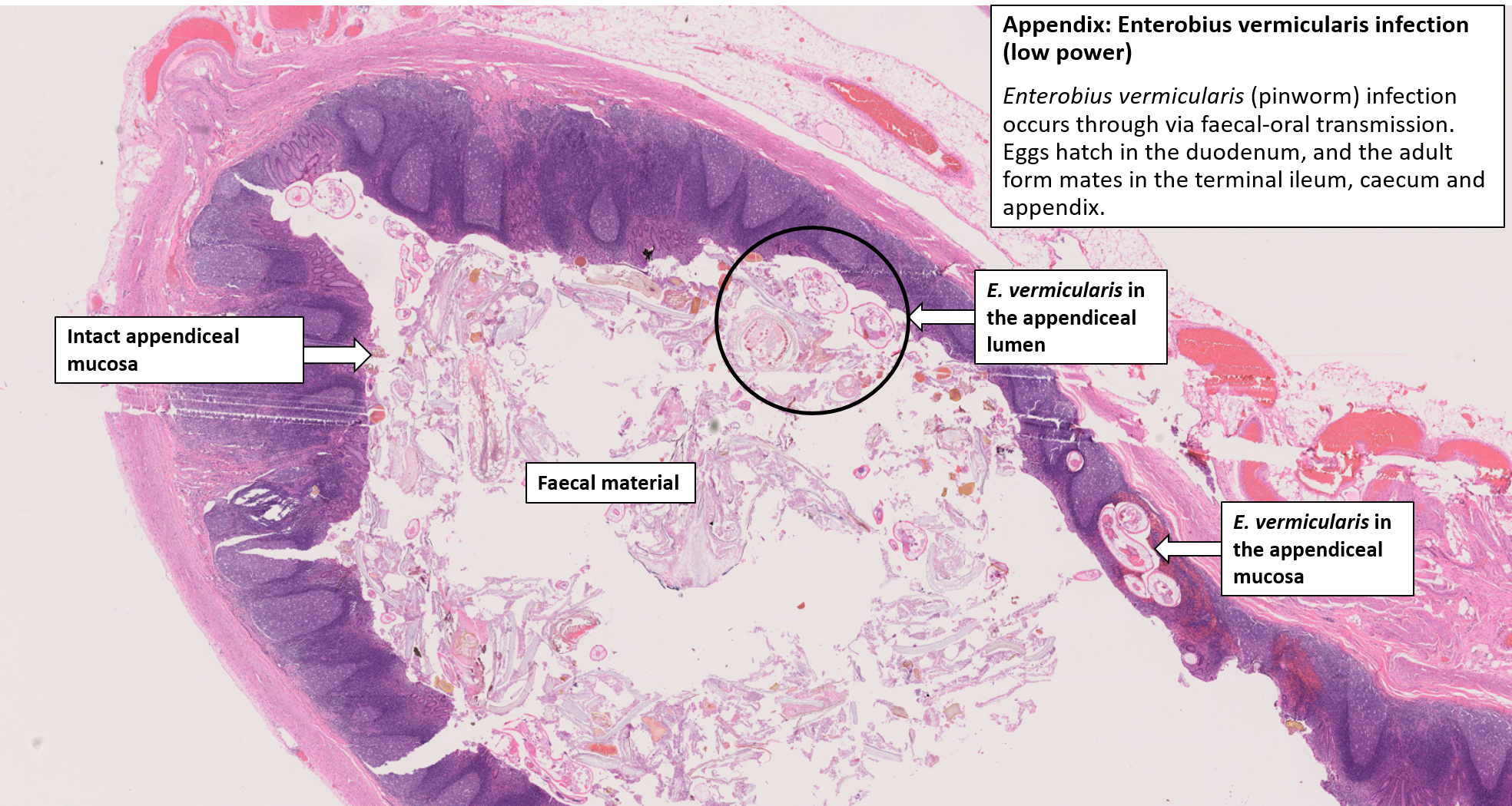 appendix histology