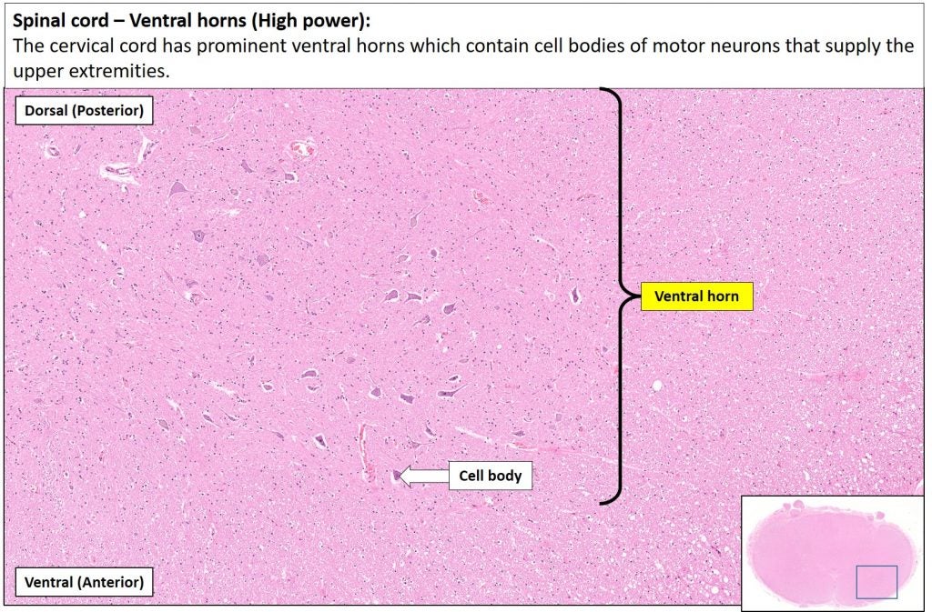 Spinal cord NUS Pathweb NUS Pathweb