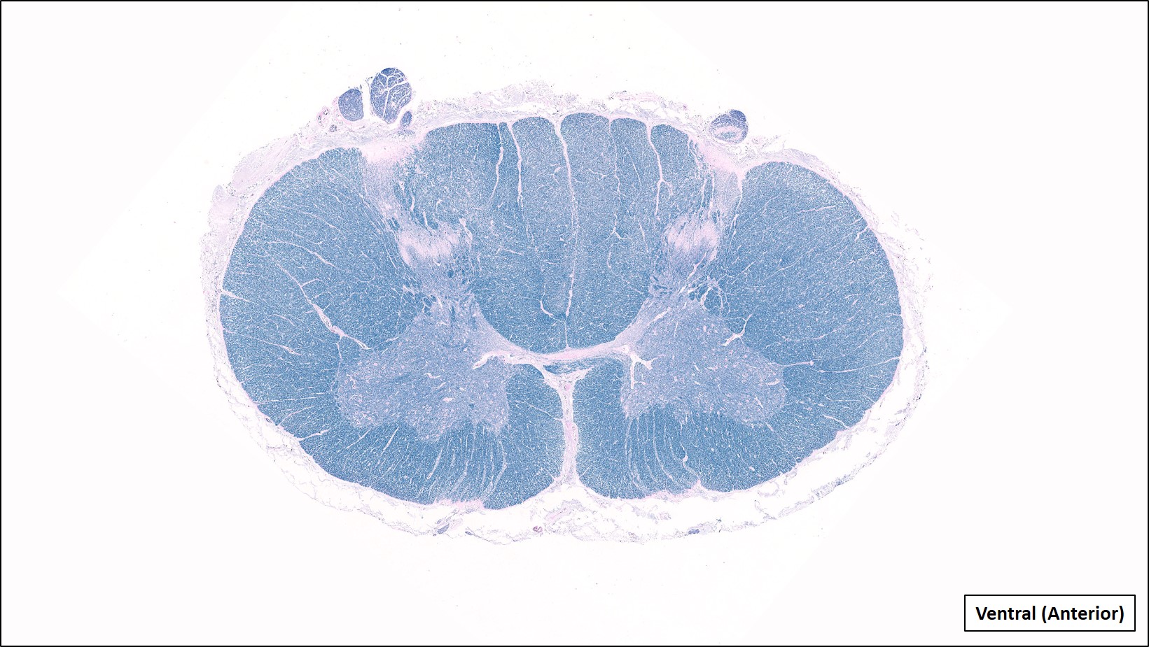 2. Spinal cord – Cervical enlargement (Very low power, Luxol fast blue [LFB] stain)