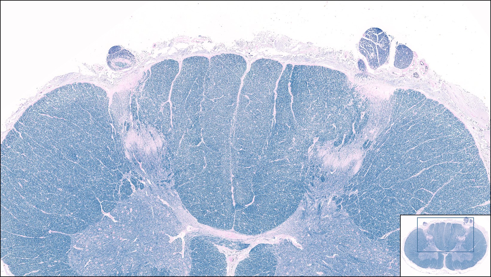 4. Spinal cord – Dorsal columns (Medium power, LFB stain)