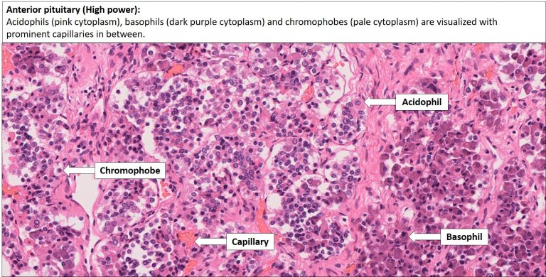 Brain – Pituitary – NUS Pathweb :: NUS Pathweb