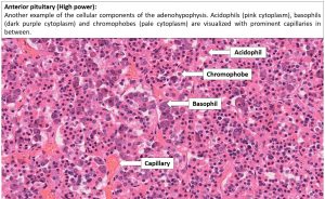 Brain – Pituitary – NUS Pathweb :: NUS Pathweb