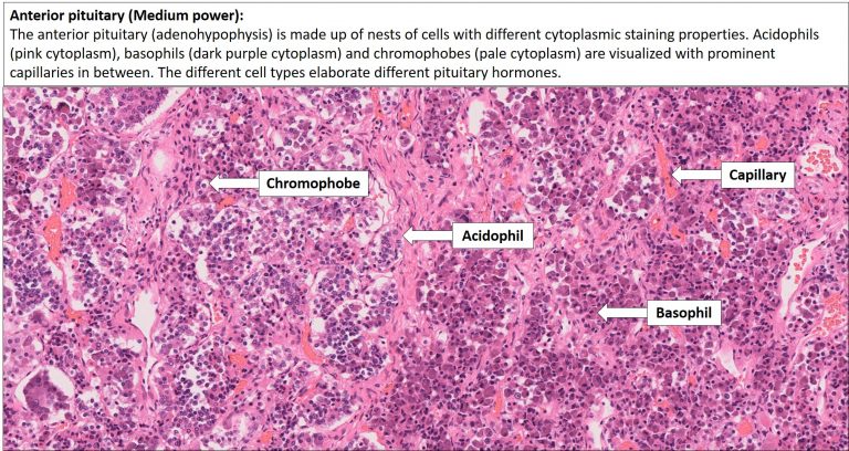 Brain – Pituitary – NUS Pathweb :: NUS Pathweb