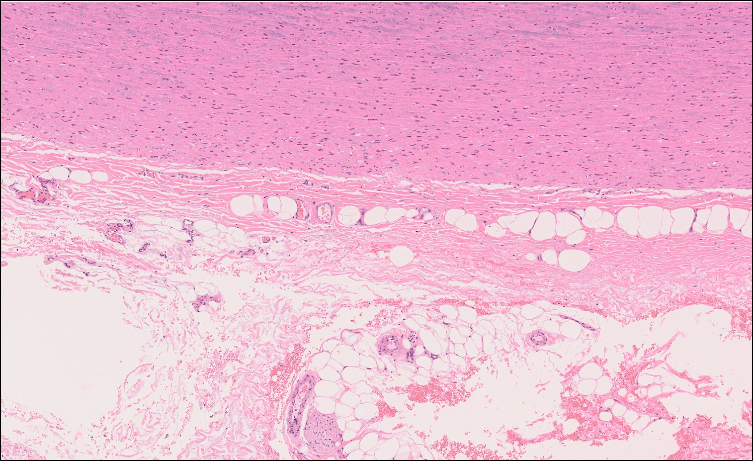 Blood vessels – Normal Histology – NUS Pathweb :: NUS Pathweb