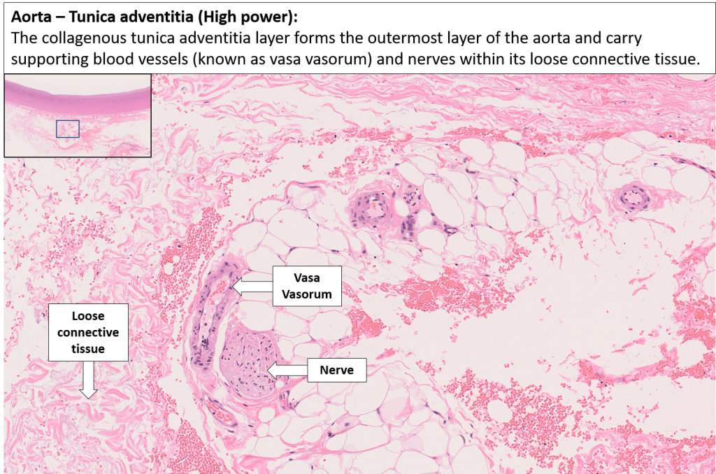 Blood Vessels Normal Histology Nus Pathweb Nus Pathweb