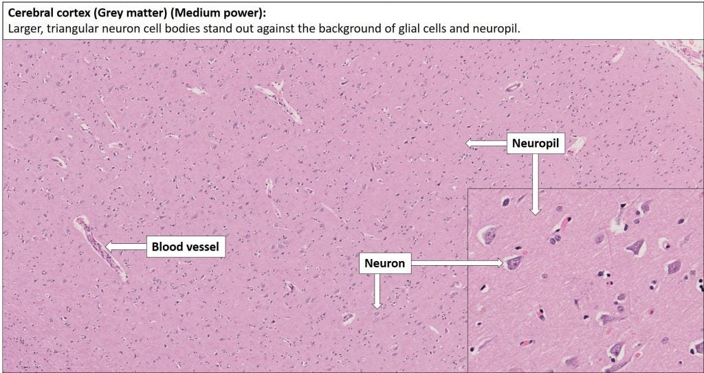 Brain – Cerebrum – NUS Pathweb :: NUS Pathweb