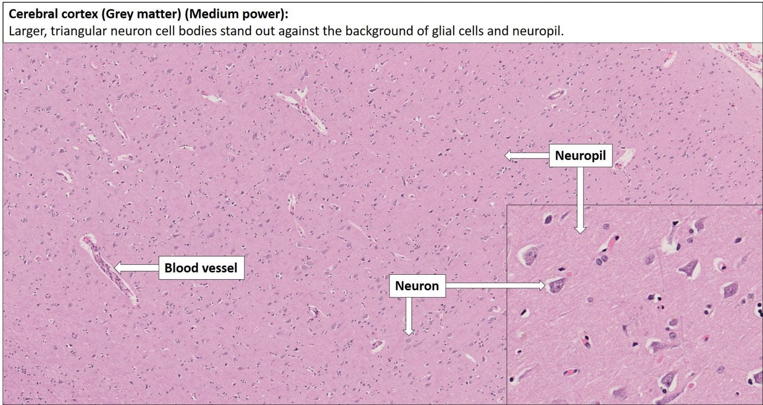 Brain – Cerebrum – NUS Pathweb :: NUS Pathweb