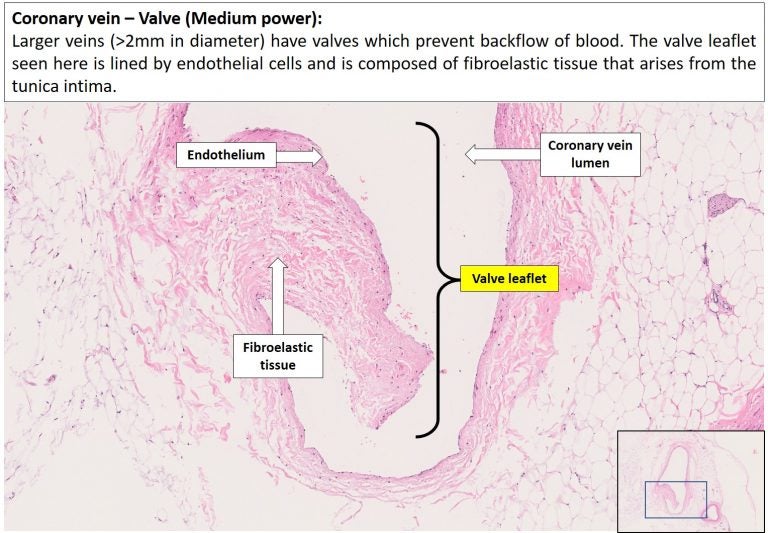 Blood vessels Normal Histology NUS Pathweb NUS Pathweb