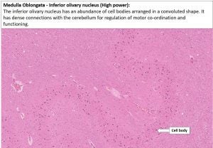 Brain – Medulla – NUS Pathweb :: NUS Pathweb
