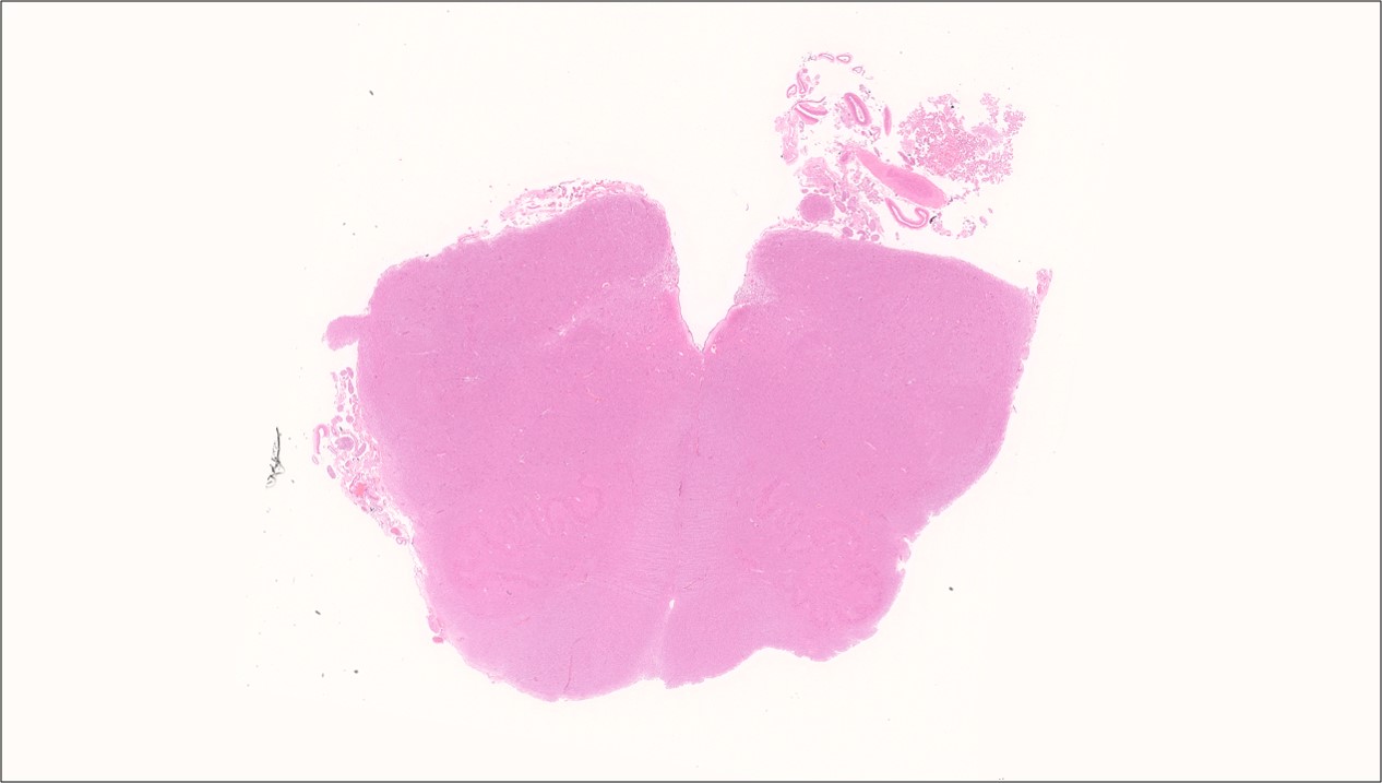 Medulla Oblongata (Low)