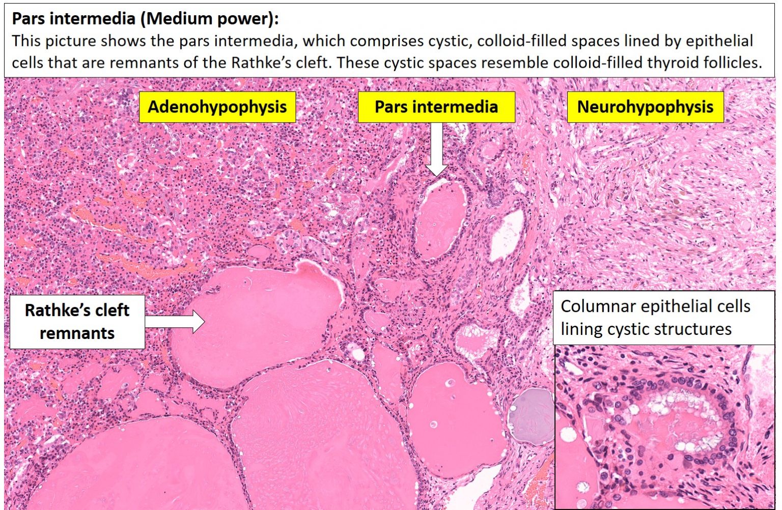 Brain Pituitary Nus Pathweb Nus Pathweb 2446