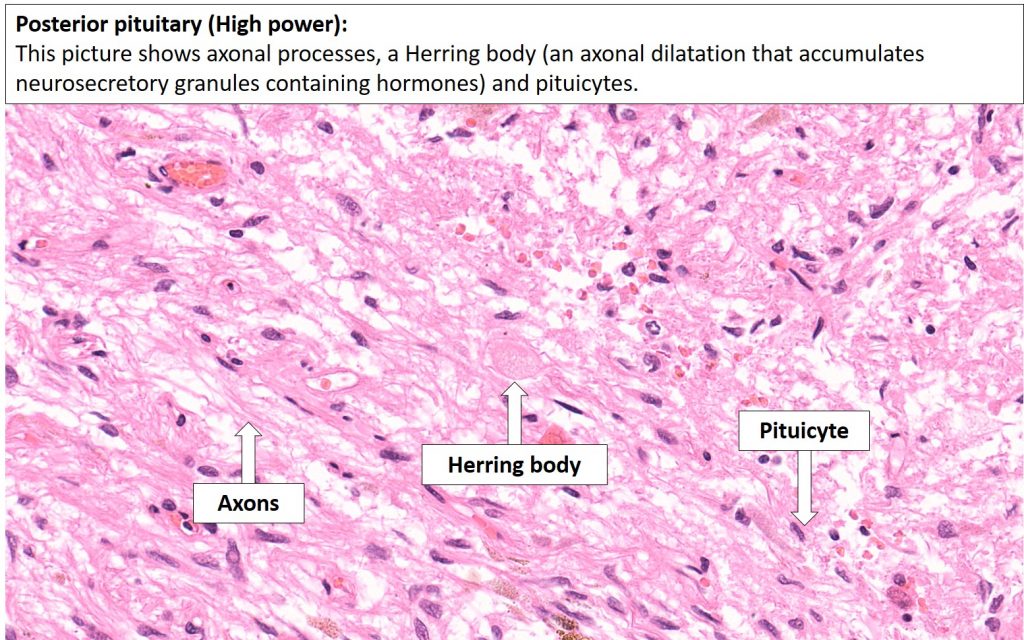 Brain – Pituitary – NUS Pathweb :: NUS Pathweb